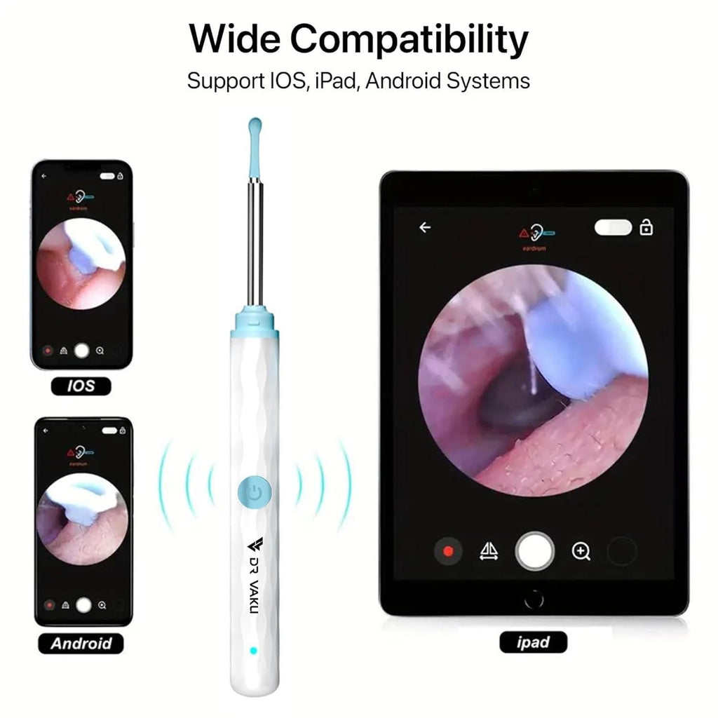 Smart Visual Ear Wax Cleaner with WiFi Camera – HD Otoscope Ear Cleaning Tool for iOS & Android (Type-C Rechargeable)