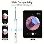 Smart Visual Ear Wax Cleaner with WiFi Camera – HD Otoscope Ear Cleaning Tool for iOS & Android (Type-C Rechargeable)