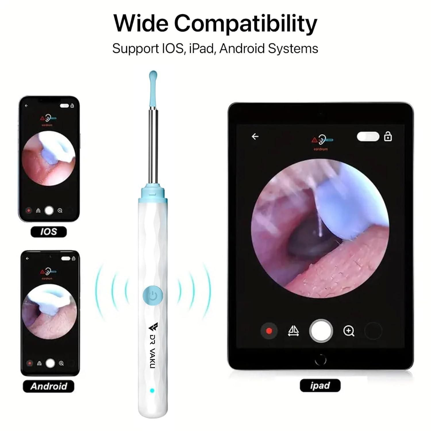 Smart Visual Ear Wax Cleaner with WiFi Camera – HD Otoscope Ear Cleaning Tool for iOS & Android (Type-C Rechargeable)