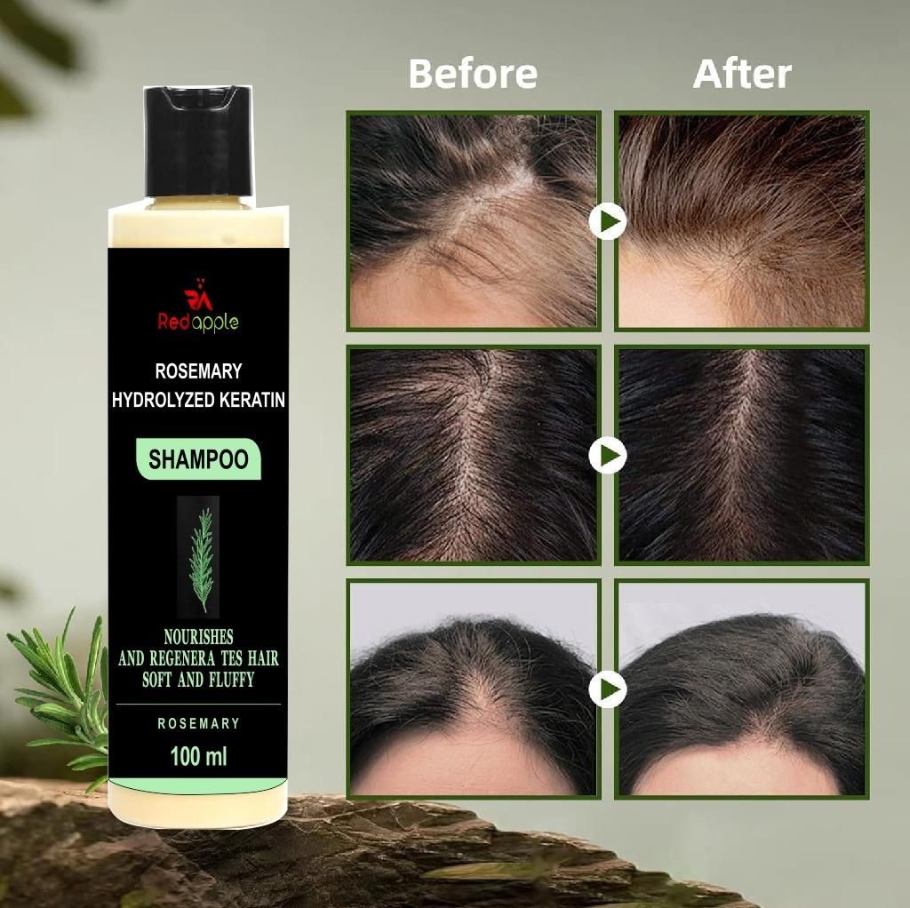 Rosemary Hydrolyzed Keratin Shampoo 100ml – Hair Repair, Strengthening & Anti-Hair Fall Formula