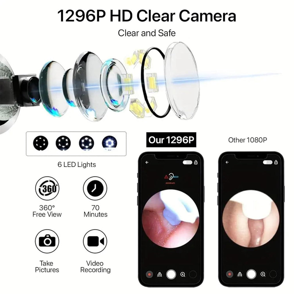 Smart Visual Ear Wax Cleaner with WiFi Camera – HD Otoscope Ear Cleaning Tool for iOS & Android (Type-C Rechargeable)