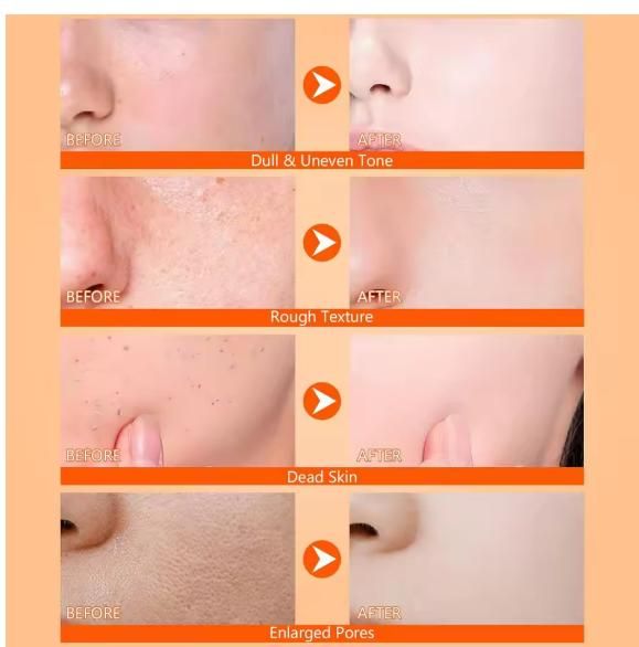 Exfoliating Kojic Acid Turmeric Spray 400ml (Pack of 2) – Brightening & Dark Spot Correcting Spray for Face & Body