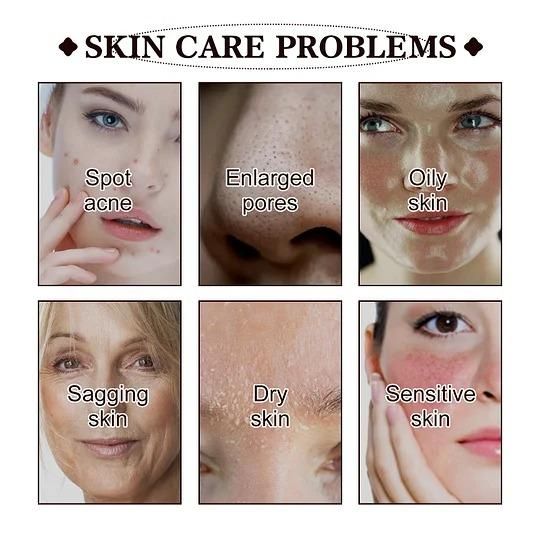 Black Tea Face Mask 100g – Acne, Dark Spots & Blackhead Removal | Deep Cleansing & Glowing Skin